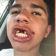 Malikai Villatte (WFTX-TV screenshot)